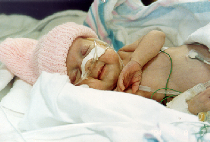 Sarah Du Bose was born 14 weeks early at UVA.