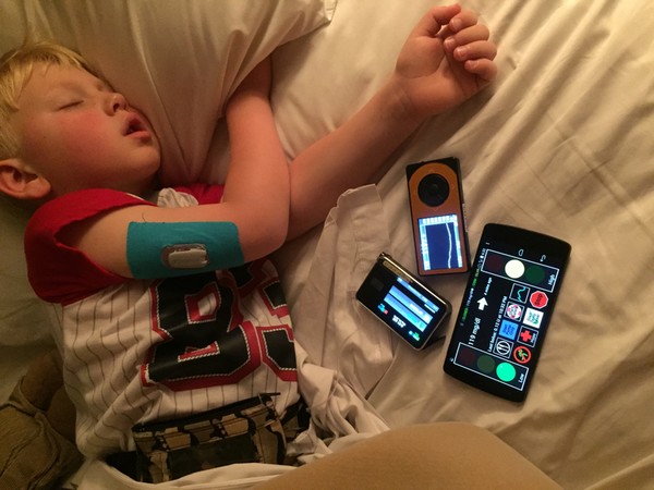 Joshua sleeps as the artificial pancreas stabilizes his blood sugar levels throughout the night.