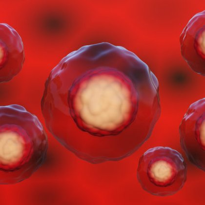 image of blood cancer