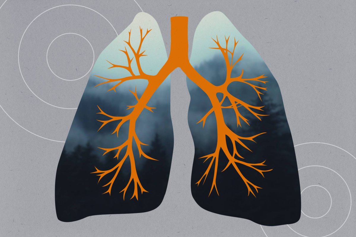 lung illustration