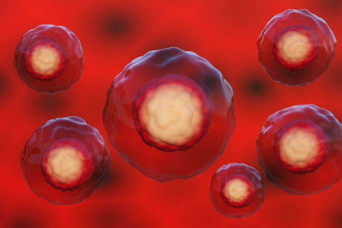 blood cancer under a microscope