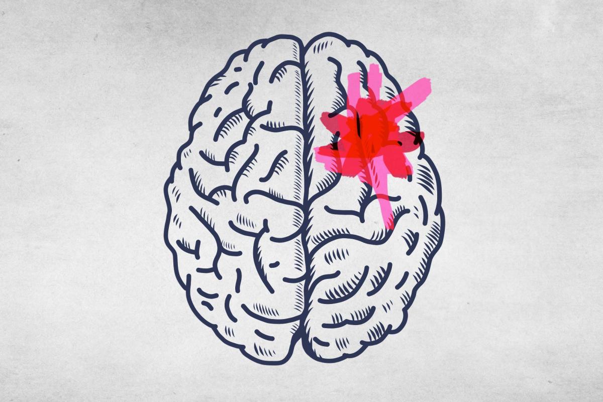 illustration of brain 